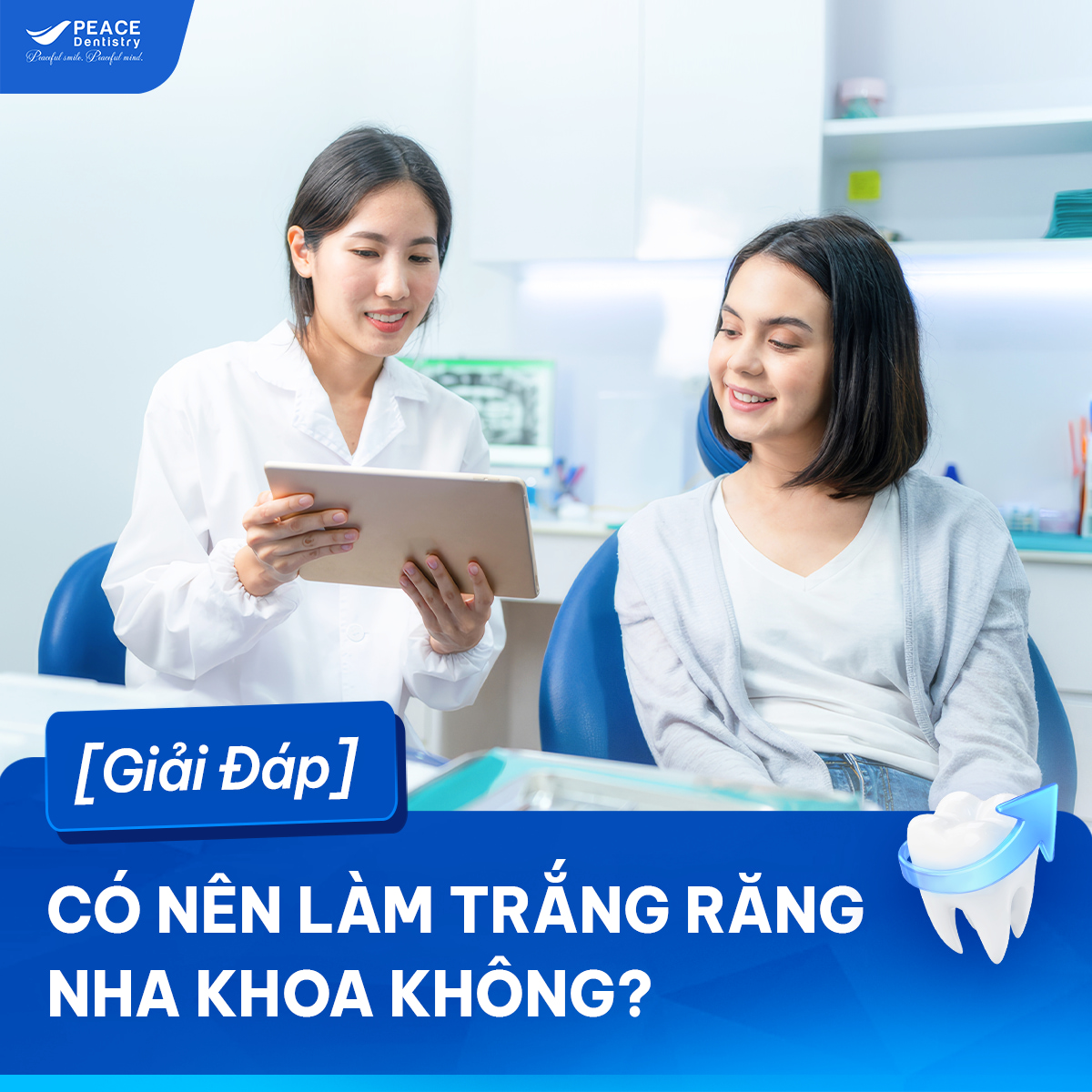có nên tẩy trắng răng tại nha khoa
