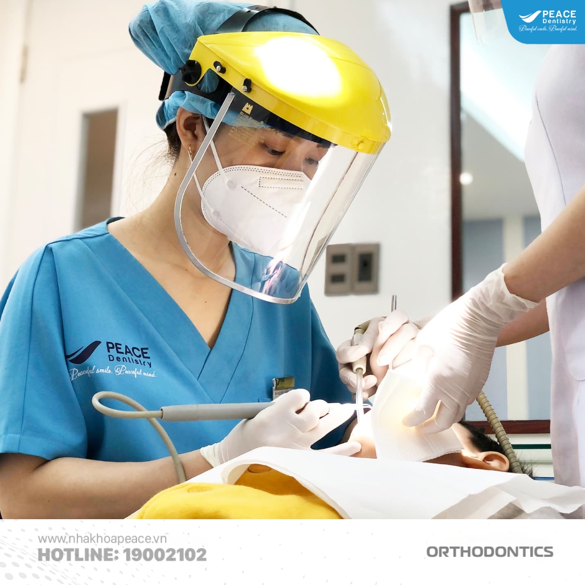 điều trị tụt lợi nhẹ khi niềng răng