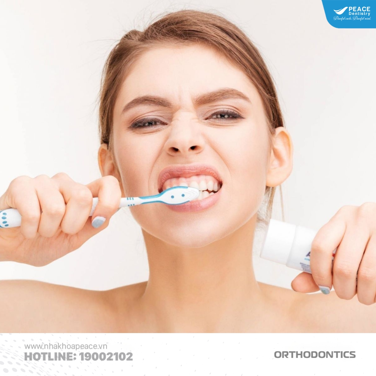 nguyên nhân niềng răng bị tụt lợi