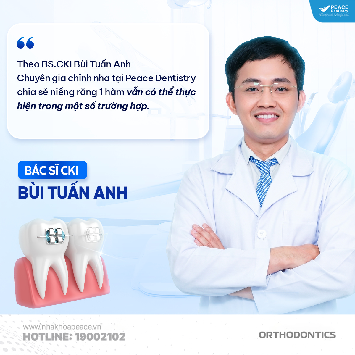 niềng răng 1 hàm có được không