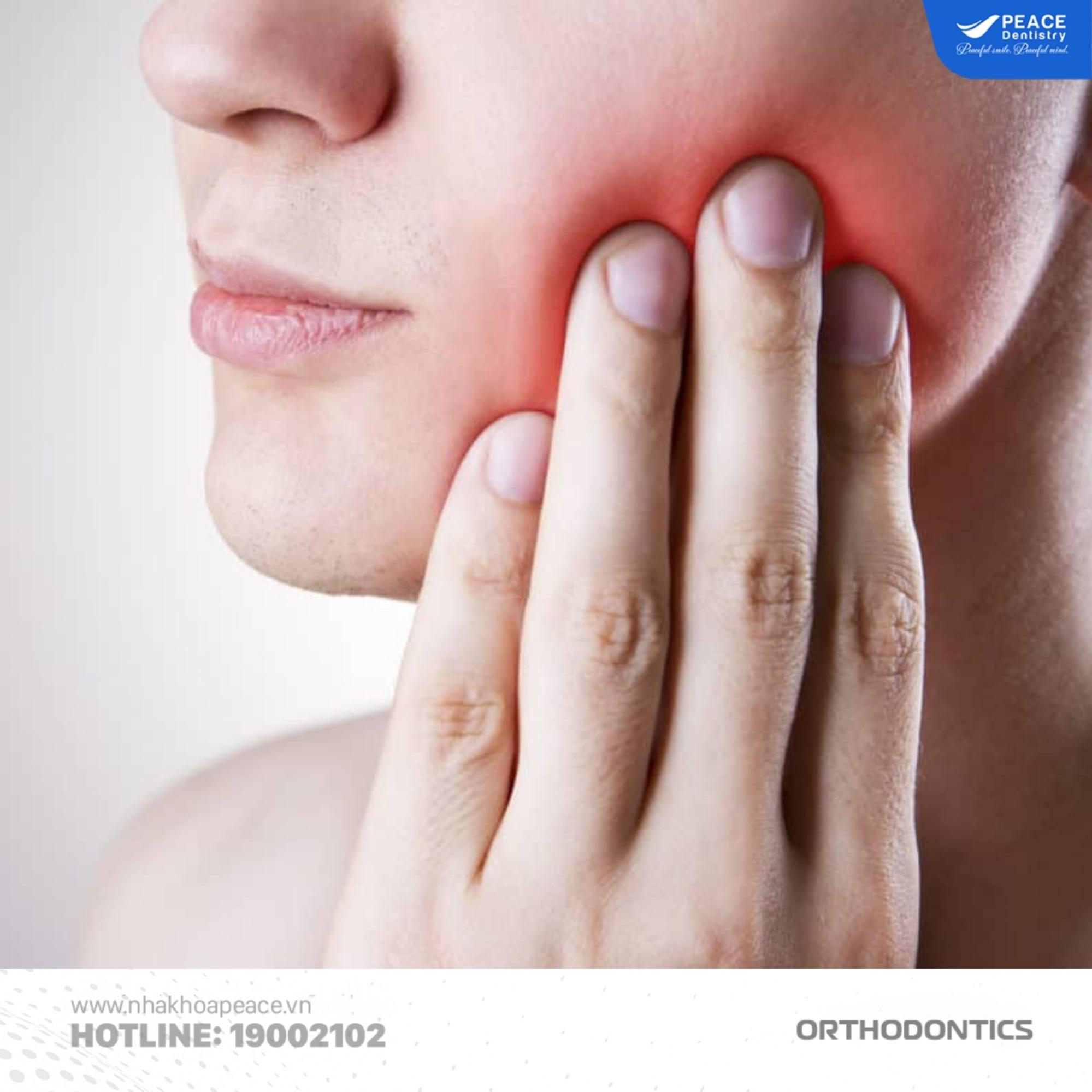 niềng răng cso đi nghĩa vụ quân sự không