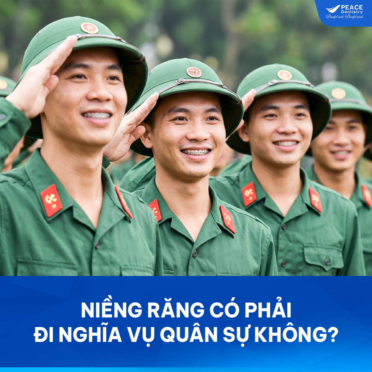 niềng răng có đi nghĩa vụ không
