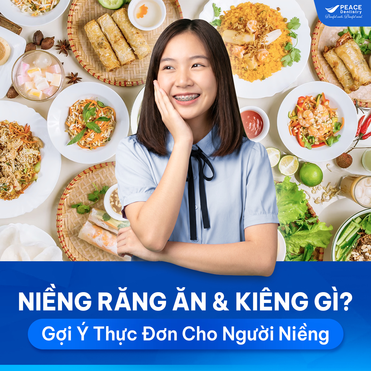 niềng răng nên ăn kiêng ăn gì
