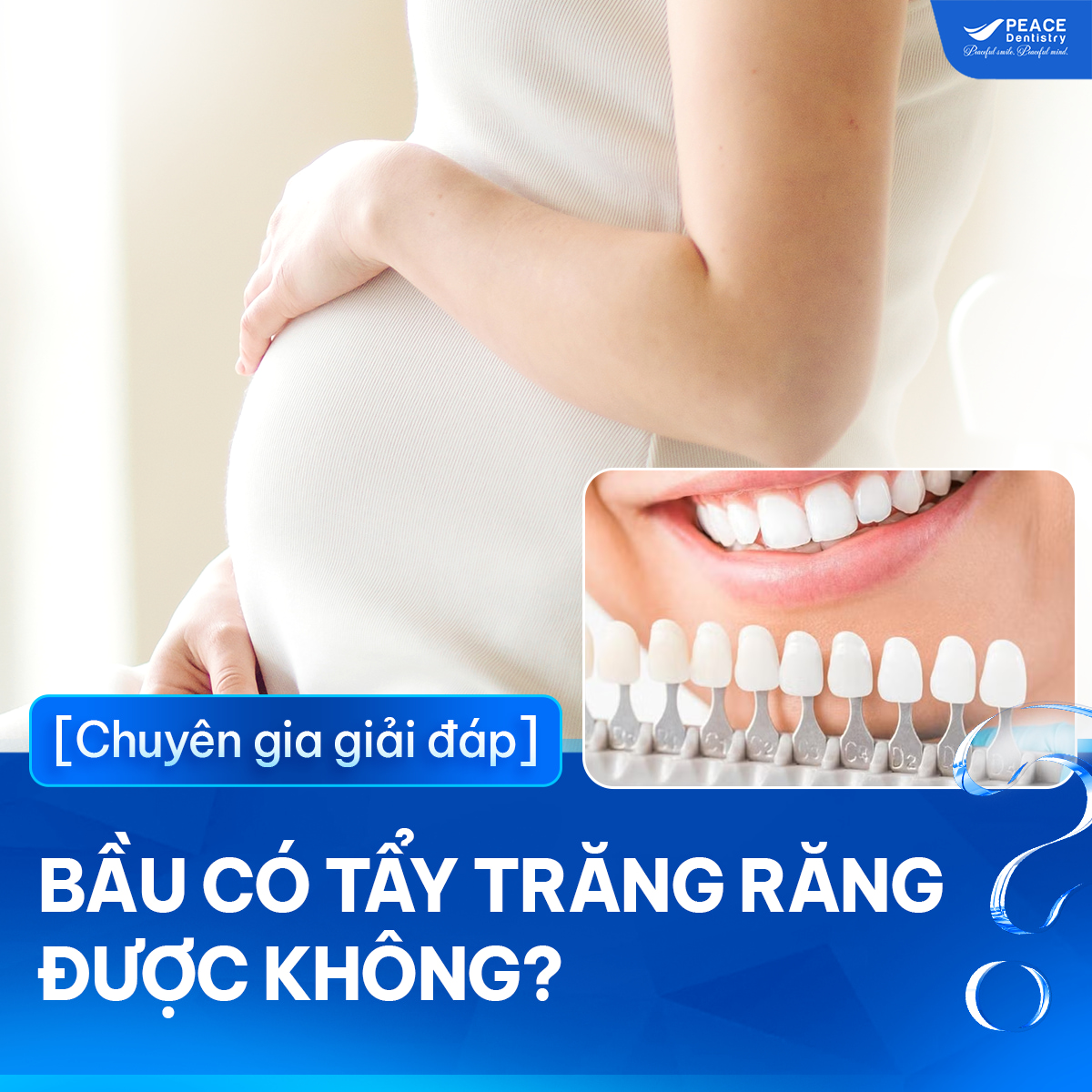 bà bầu có tẩy trắng răng được không