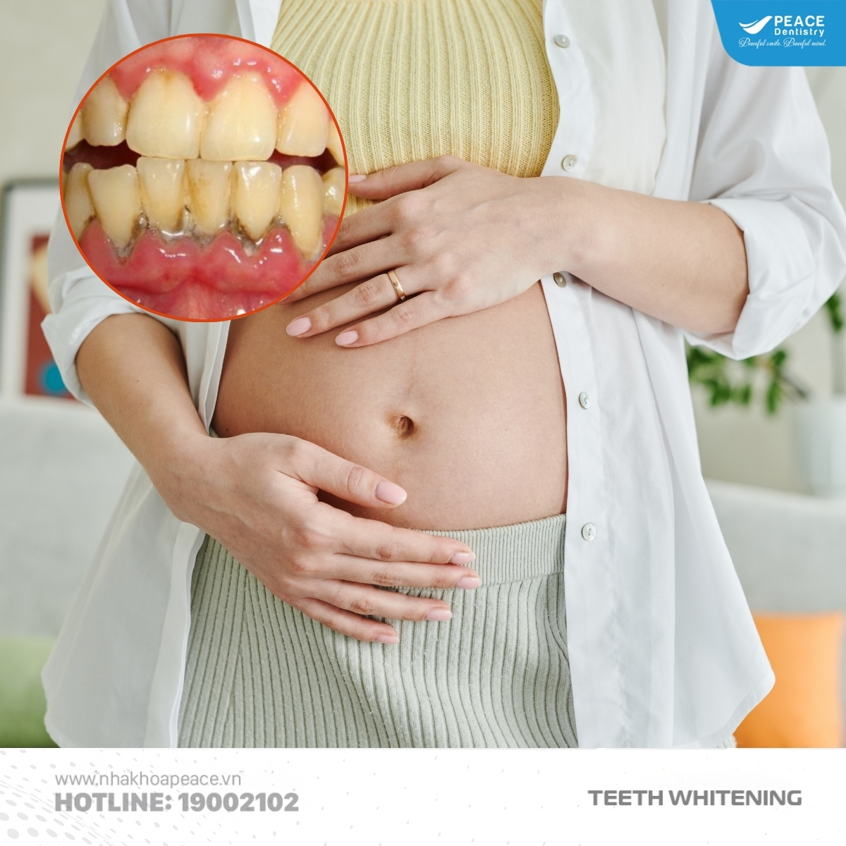 bầu có tẩy trắng được không