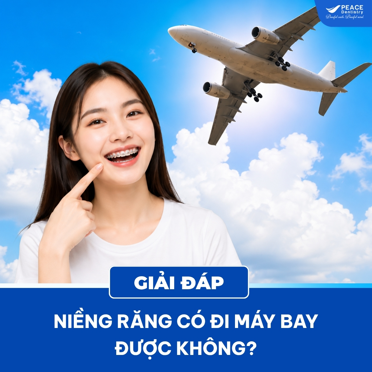 niềng răng có đi máy bay được không