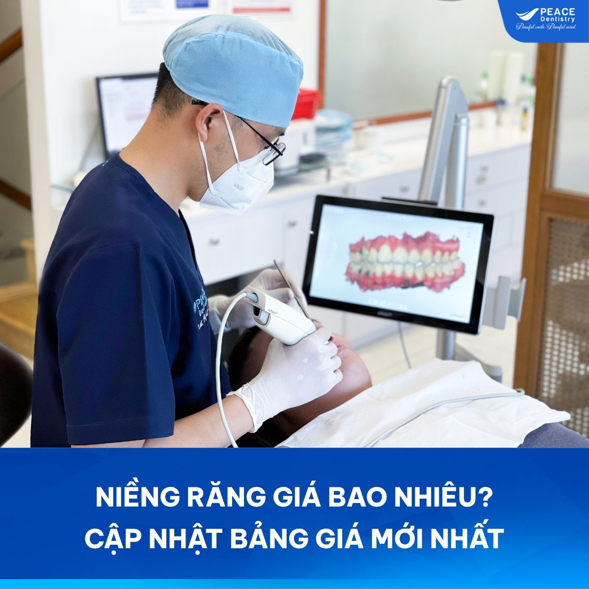 niềng răng giá bao nhiêu