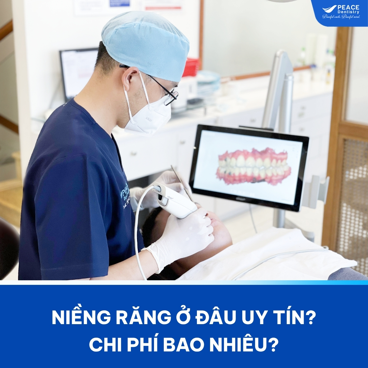 niềng răng ở đâu tốt uy tín tại tphcm