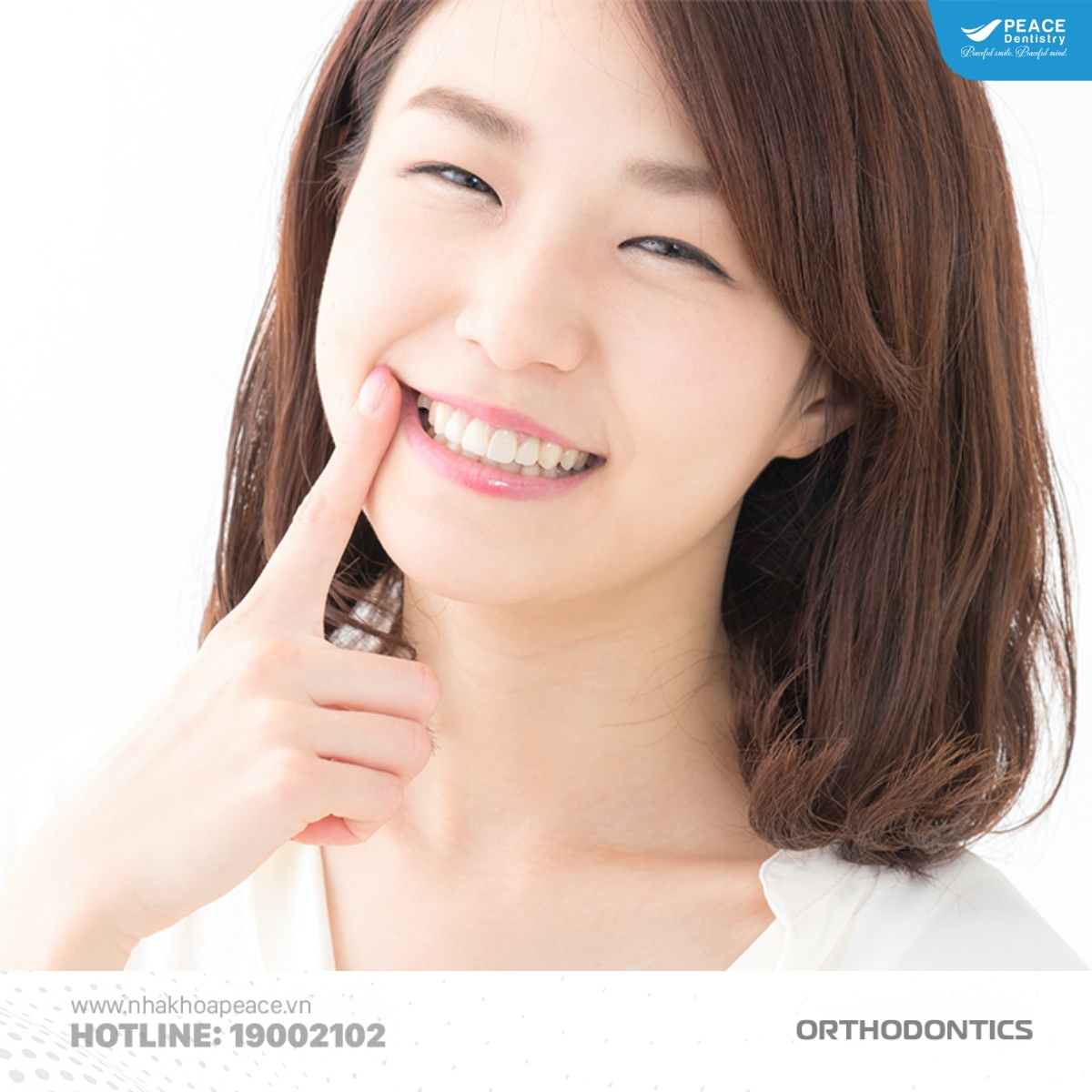 tháo niềng răng khi khớp cắn chuẩn
