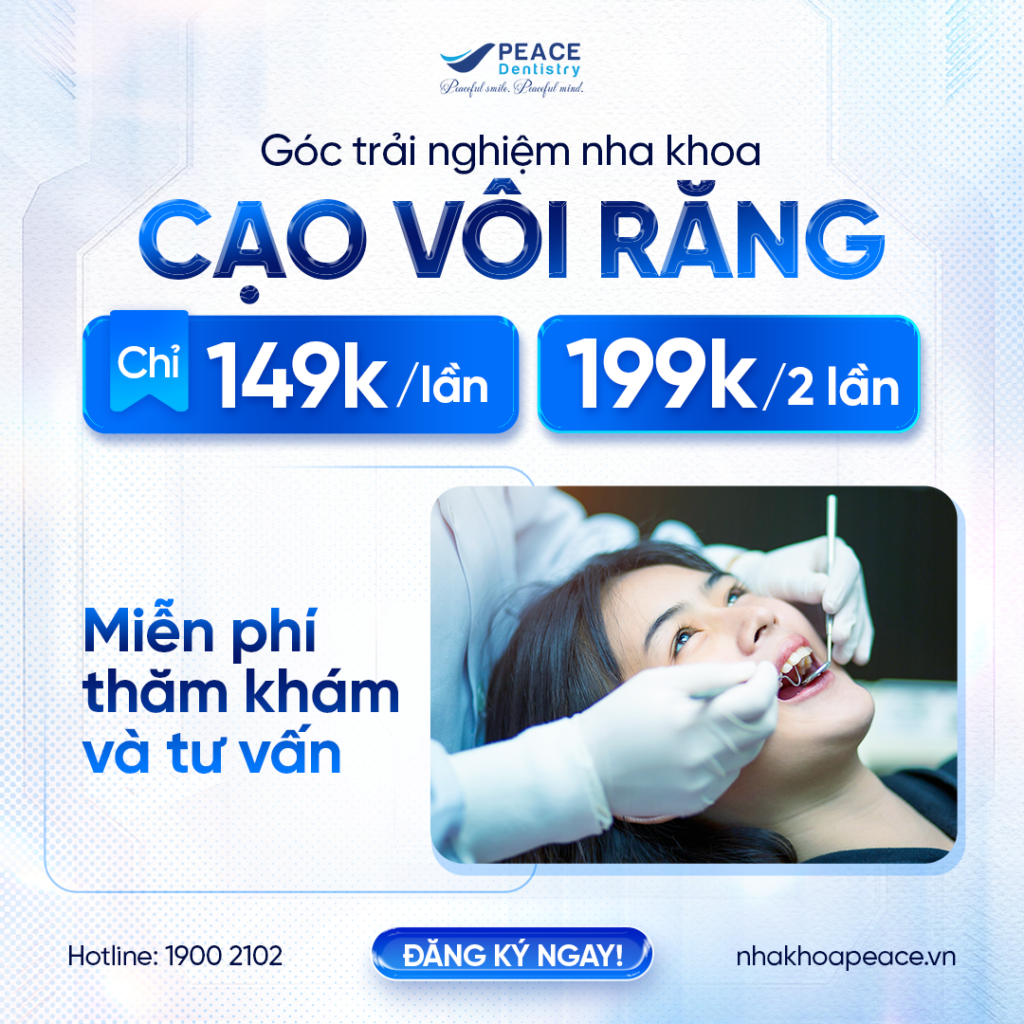 ưu đãi cạo vôi định kỳ