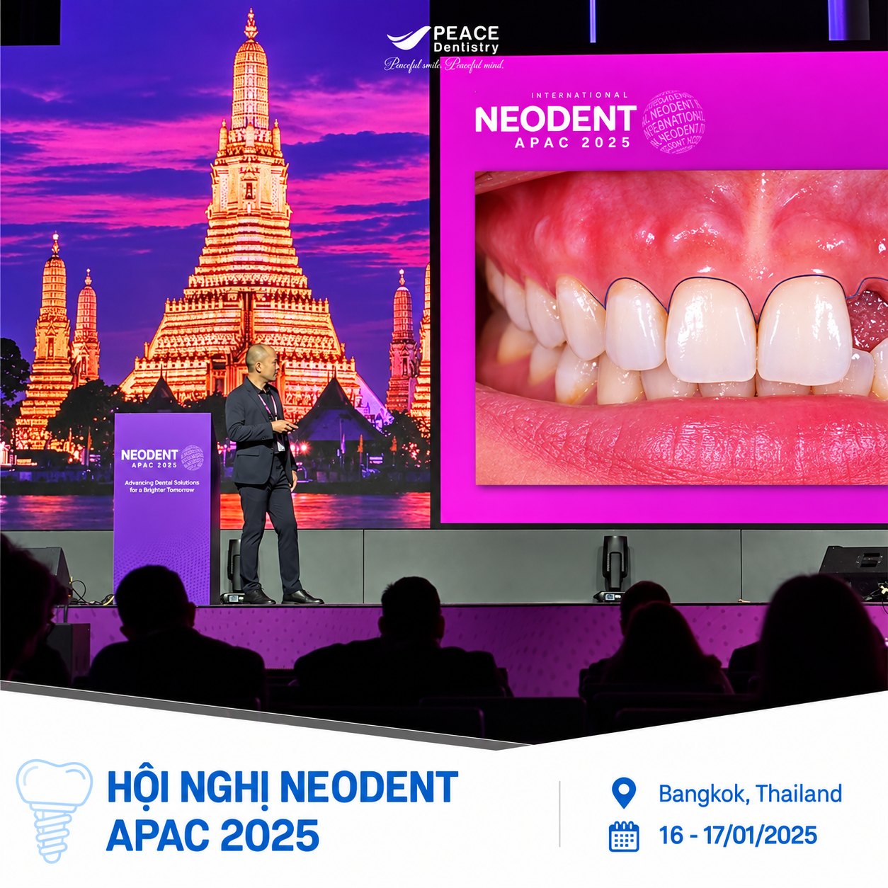 Thạc Sĩ Bác Sĩ CKII Thân Trọng Nguyên - Tham gia báo cáo tại hội nghị Implant Neodent Apac 2025
